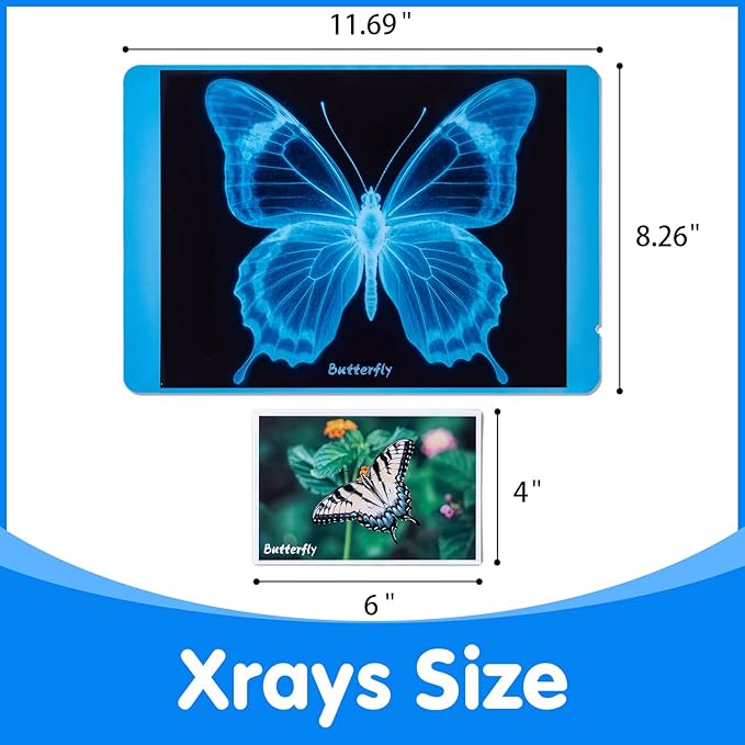 Insect Xrays – Bug Science Kit - Bug Detectives for Kids, Light Table Accessories, STEM Learning Insect X-Ray Set